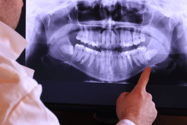 Best Emergency Dental Surgery in Brewer, ME