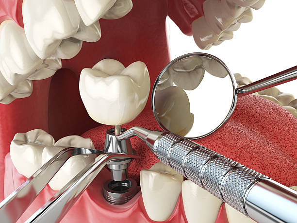 Best Walk-In Emergency Dentist in Brewer, ME